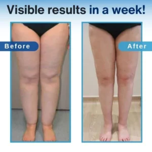 Alternative view of SlimTech Leg Shaping Massager