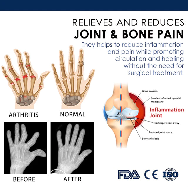 Superb Bone regeneration cream - Image 3