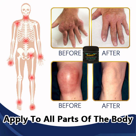 Superb Bone regeneration cream - Image 4