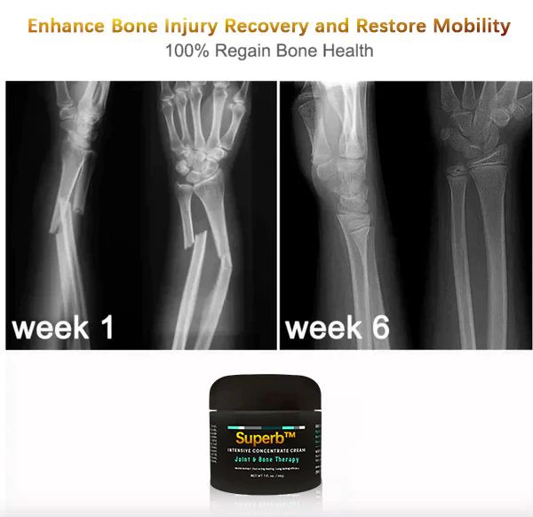 Superb Bone regeneration cream - Image 5
