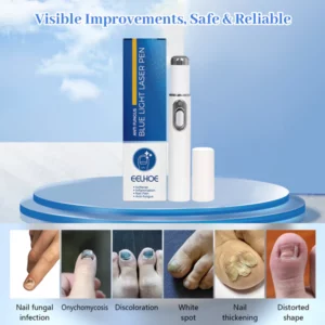 ARRIVALS Antifungal Laser Device Without Any Side Effects