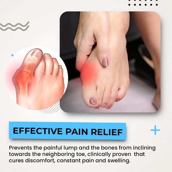 Alayna™ 3D Bunion Splint Corrector - Image 6