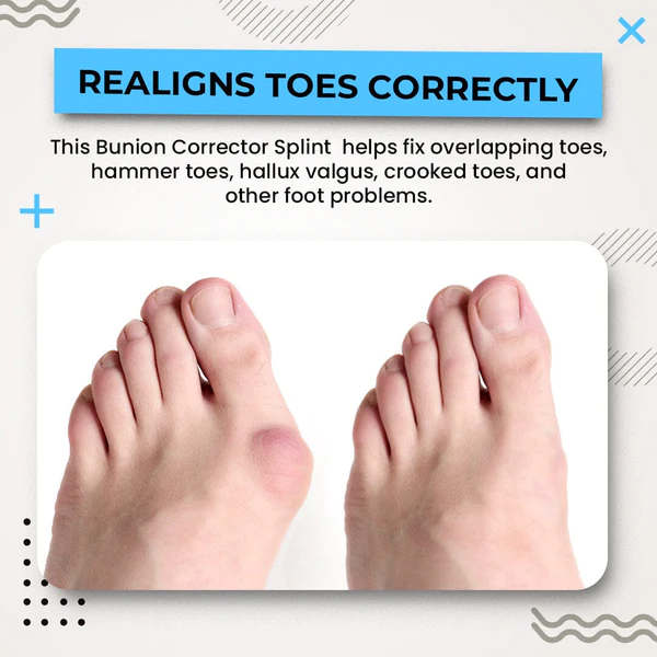 Alayna™ 3D Bunion Splint Corrector - Image 7