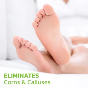 Alternative view of CC™ IHerbal Foot Callus And Corns Removal Soak