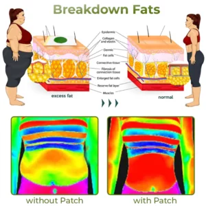 Alternative view of CC™ Perfect Detox Slimming Patch