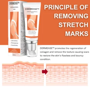 Alternative view of DERMEASE™ Stretchmarks Removal Cream