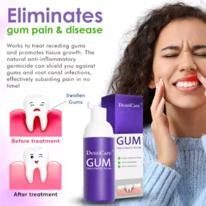 Alternative view of DentiCare™ Gum Treatment Foam