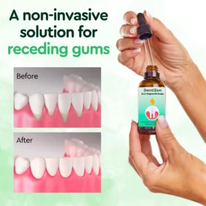 Alternative view of DentiZen™ Gum Regrowth Drops