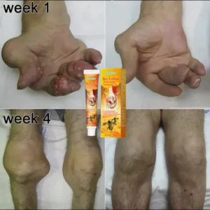 Alternative view of Flashing New Zealand Bee Venom Professional Treatment Gel