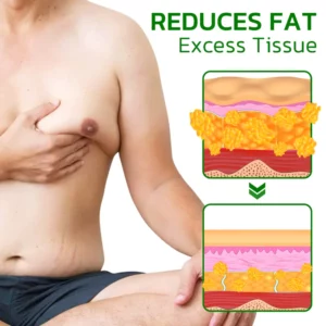 Alternative view of GFOUK™ TurmericMax Gynecomastia Compress Patch