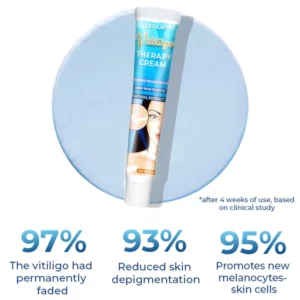 Alternative view of GFOUK Vitiligo-Therapie-Creme