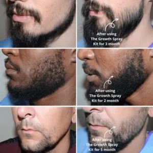 Alternative view of Hair Growth Kit