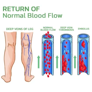 Alternative view of HealLegs™ Fat Burning Shaping & Varicose Veins Immediate Relief Burst Beads Patch