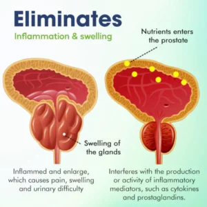 Alternative view of KK™ Prostate Treatment Drops