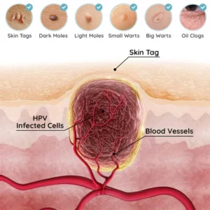 Alternative view of MicroDarts SkinTAG Blemish Patches