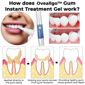 Alternative view of Oveallgo Gum Instant Treatment Gel