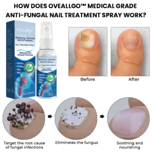 Alternative view of Oveallgo™ Medical Grade Anti-Fungal Nail Treatment Spray