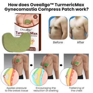 Alternative view of Oveallgo™ TurmericMax Gynecomastia Compress Patch