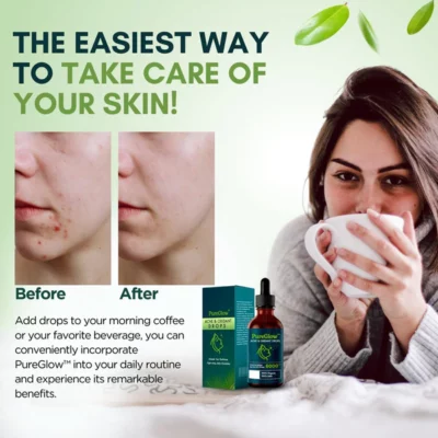 PureGlow™ Acne & Oxidant Drops