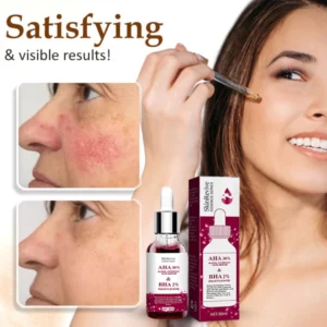 Alternative view of SkinRevive™ Rosacea Cure Serum
