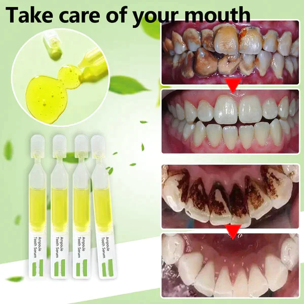 SmileMate Removal of tartar and plaque bacteria and various oral problems - Image 3