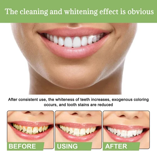 TLOPATM Ampoule Toothpaste - Image 6