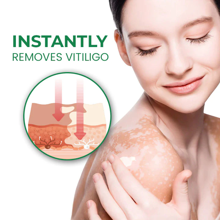 VitiligoFix Revitalize Elixir - Image 4