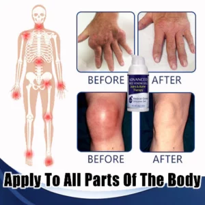 Alternative view of Wewersh® Advanced Joint & Bone Therapy Bee Venom Gel