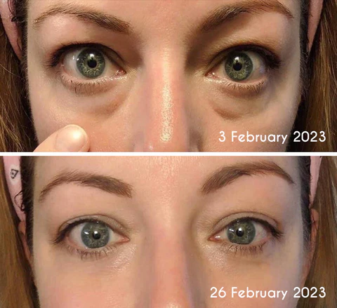 flysmus™ DEleventh Pro-Xylane Active Eye Cream