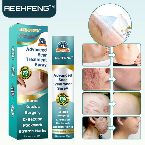 AEEHFENG Advanced Scar Treatment Spray