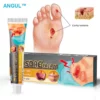 ANGUL™ Bedsore Treatment Cream