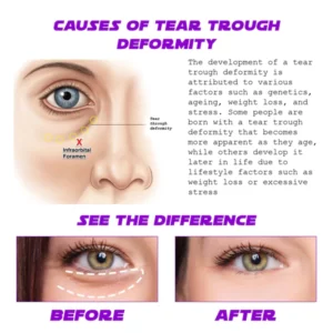 Alternative view of ATTDX AntiAging ProXylane Hydrating EyeCream