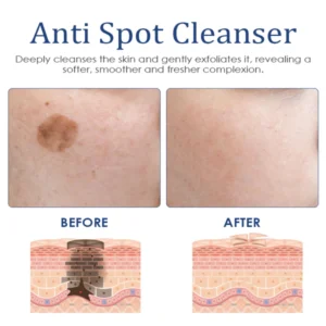 ATTDX AntiSpot Body Whitening Cleanser