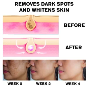 ATTDX AntiSpot Body Whitening Cleanser