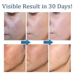ATTDX AntiSpot Body Whitening Cleanser