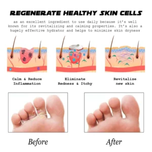 ATTDX AthletesFoot FungusRelief TreatmentSpray