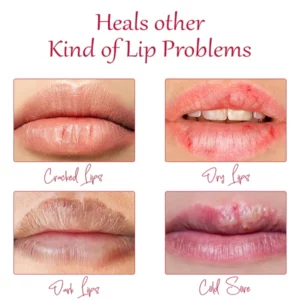 Alternative view of ATTDX Day&Night Honey Moisturizing Lip Oil
