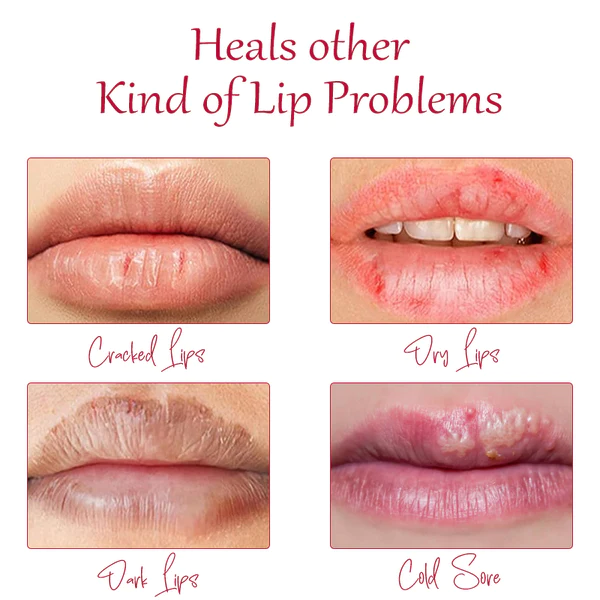 ATTDX Day&Night Honey Moisturizing Lip Oil - Image 2