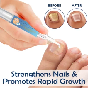 Alternative view of ATTDX NailRepair Fungus Treatment Pen