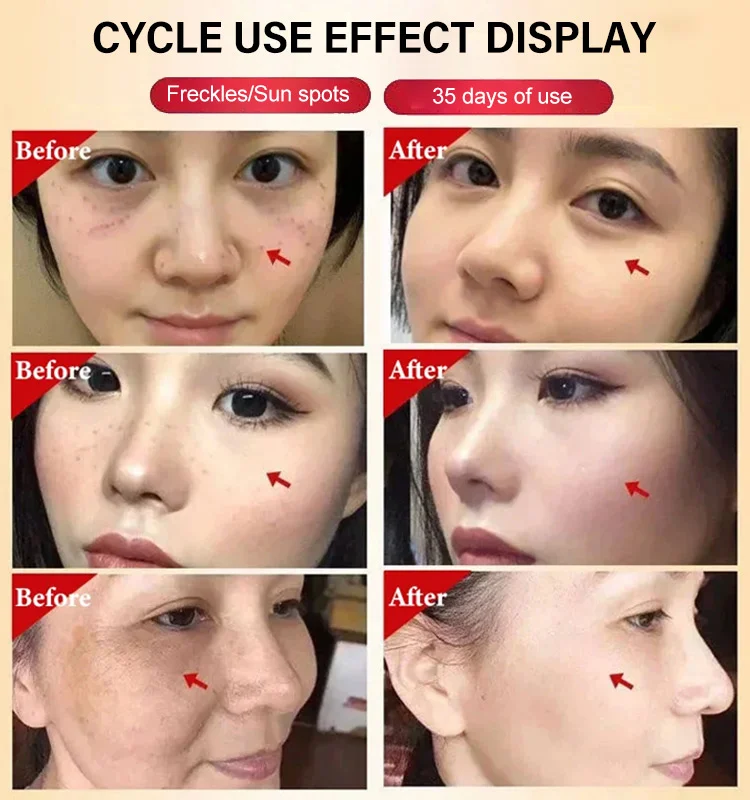 Brightening Freckle Cream - Image 4