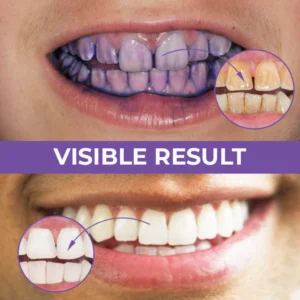 Alternative view of CC™ Deluxe Herbal Teeth Whitening Mousse