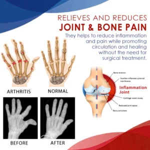 Alternative view of CC™ Joint & Bone Therapy Gel