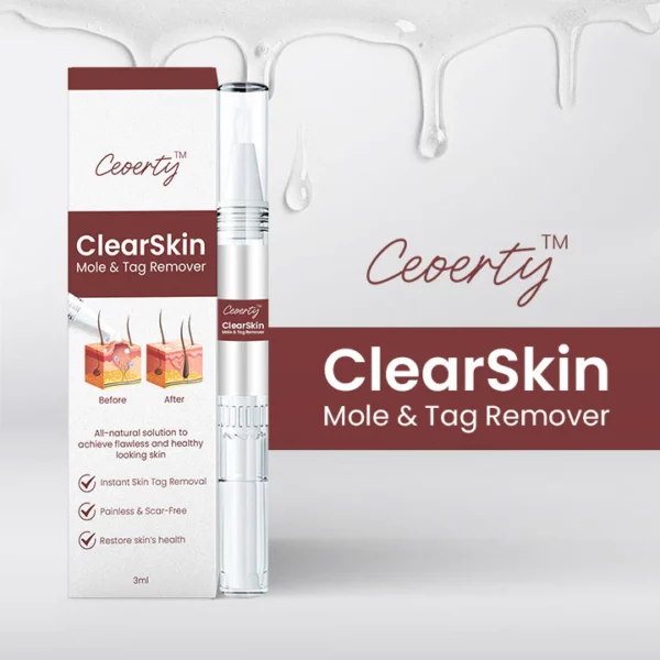 Ceoerty ClearSkin Mole & Tag Remover