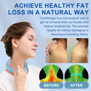 Alternative view of CoolTime™ Ion Lymphatic Relief Coolsculpting Neck Tube