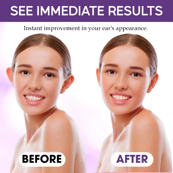 CosmEar™ Sticker Corrector - Image 3