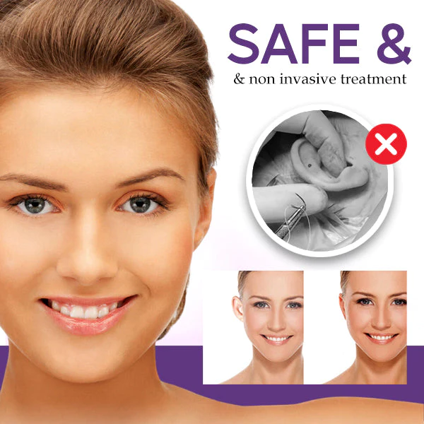 CosmEar™ Sticker Corrector - Image 4