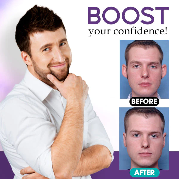 CosmEar™ Sticker Corrector - Image 6