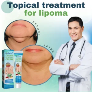 DermaFix™ Lipoma Removal Cream