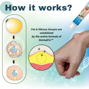 DermaFix™ Lipoma Removal Cream