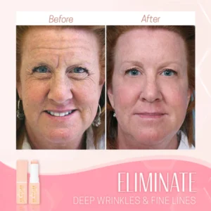 Dr Miller Wrinkle Bounce Balm